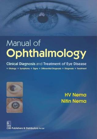 Book cover number 1 for Manual Of Opthalmology written by H. V. Nema, Nitin Nema published by CBS Publishers & Distributors Pvt. Ltd.