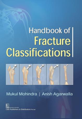 Book cover number 1 for Handbook Of Fracture Classifications written by Mukul Mahindra, Anish Agarwalla published by CBS Publishers & Distributors Pvt. Ltd.